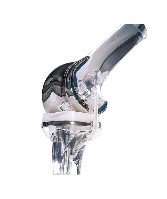 2.7.1_Orthopedics_Joint-Reconstr