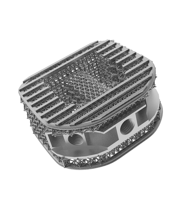 2.7.5_Manufactured-Parts_Laser-P